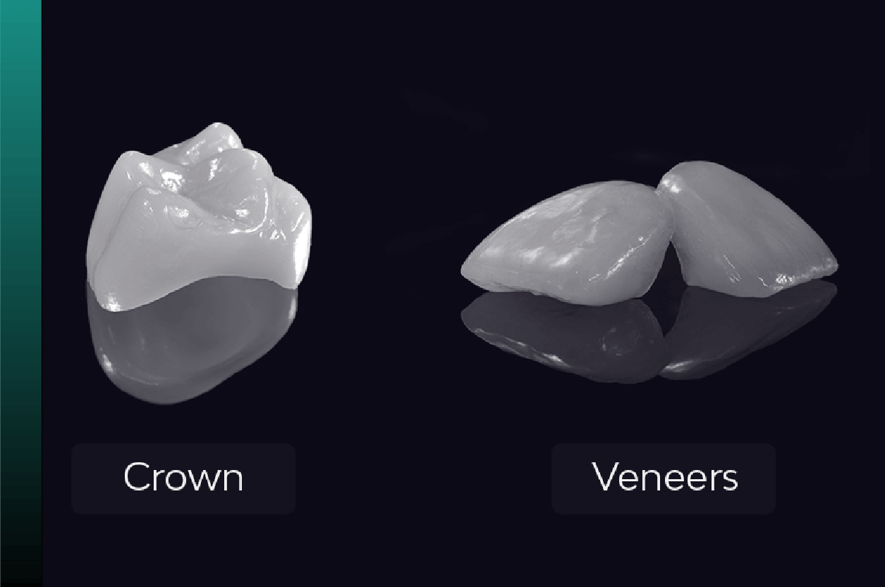 Esthetic Dentistry