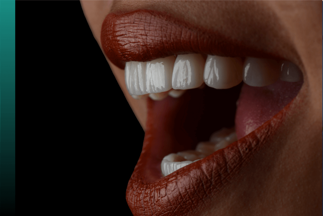 Hollywood Smile